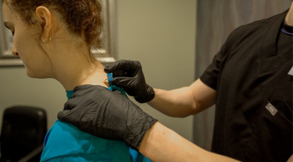 dry-needling-star-physical-therapy-clinic-covington-la